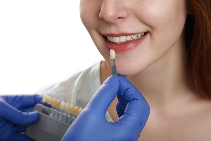 Affordable Dental Implants for Seniors: A Complete Guide to Smiling with Confidence